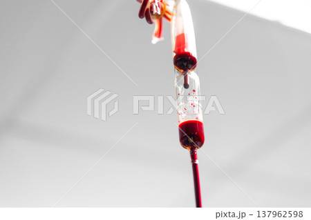 Close up of blood flowing through IV drip chamber showing medical transfusion healthcare treatment emergency care and life saving procedure concept 137962598