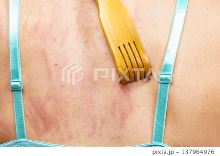 Woman scratching her itchy back using scratcher Woman scratching her itchy back using scratcher 137964976