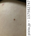 黒子 137982747
