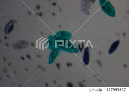 Paramecium Protozoa Under Microscope Examination Detail Paramecium Protozoa Under Microscope Examination Detail 137995367
