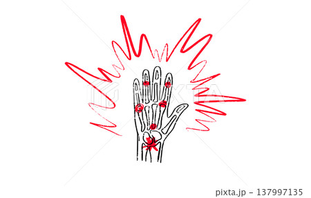 Arthritis Sketch Poster Arthritis Sketch Poster 137997135