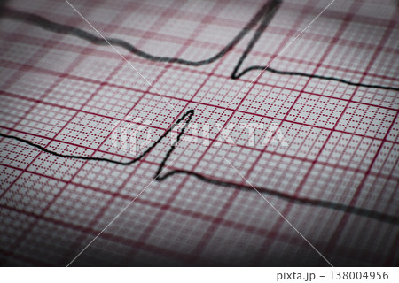 Health care background of Electrocardiogram plot 138004956
