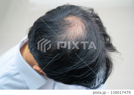 Bald in the middle head and begin no loss hair glabrous of mature Asian business smart active office man. Bald in the middle head and begin no loss hair glabrous of mature Asian business smart active office man. 138017479
