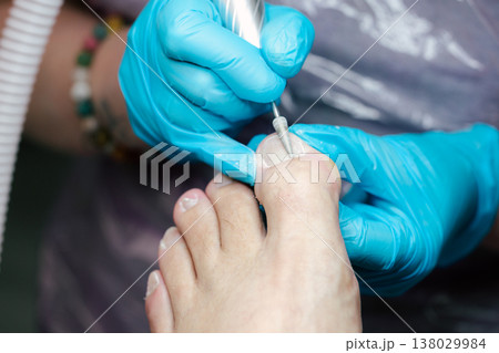 Professional Pedicure Treatment. Nail Technician Using Electric Drill on Toenails in Beauty Salon with Blue Gloves. Care and cosmetic treatment with proper hygiene standards.  138029984