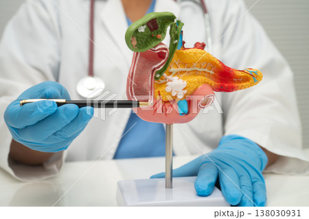 Pancreatitis, pancreatic cancer, Asian doctor with pancreas, gallbladder and bile duct human anatomy model at hospital. 138030931