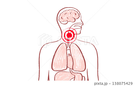 Throat inflammation pain Throat inflammation pain 138075429