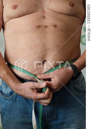 close-up of a fat man measuring his belly close-up of a fat man measuring his belly 138082303