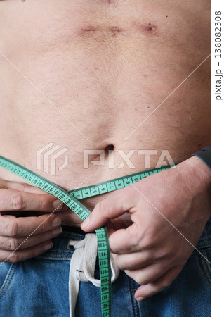 close-up of a fat man measuring his belly close-up of a fat man measuring his belly 138082308