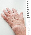 Senior woman hand skin with signs of aging, female hand showcasing dryness wrinkles covering surface 138082991