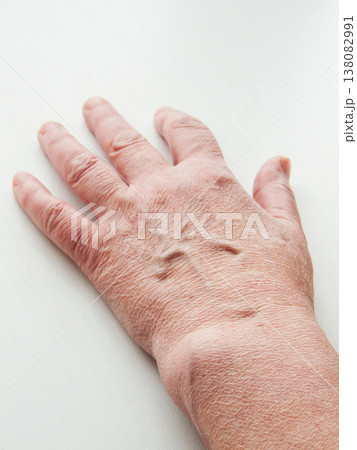 Senior woman hand skin with signs of aging, female hand showcasing dryness wrinkles covering surface 138082991