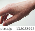 Senior woman hand aging symptoms, dry thin skin on back of hand, dehydration and vitamin deficiency. 138082992