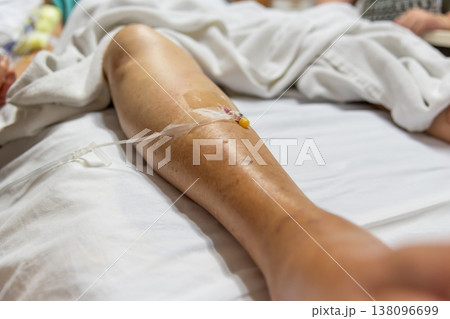 Close up of patient arm with IV catheter on hospital bed highlighting medical treatment recovery care monitoring and clinical environment with soft fabric and copy space 138096699