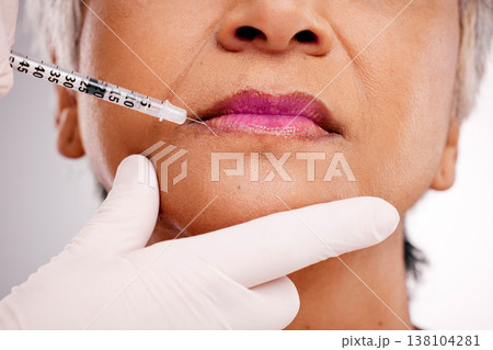 Mouth needle, plastic surgery hands and woman with closeup surgeon augmentation, lip filler or silicone treatment. Studio spa clinic, collagen injection and client transformation on white background Mouth needle, plastic surgery hands and woman with closeup surgeon augmentation, lip filler or silicone treatment. Studio spa clinic, collagen injection and client transformation on white background 138104281