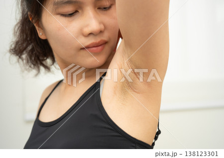 Asian woman have problem black armpit beauty skin care. 138123301