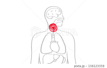 Throat inflammation pain Throat inflammation pain 138123359