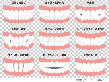 歯並び・咬み合わせイラスト 歯並び・咬み合わせイラスト 138138745