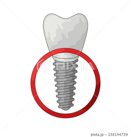 Illustration of dental implant 138144739