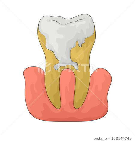 Illustration of Dental Disorders 138144749