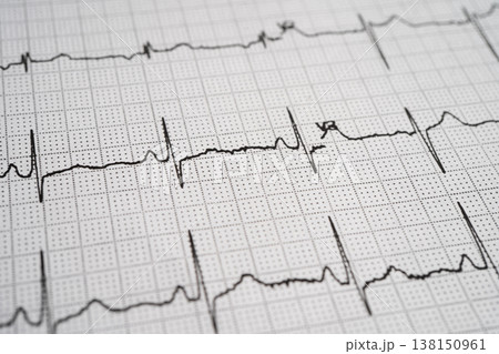 Red heart on electrocardiogram ECG with red heart, heart wave, heart attack, cardiogram report. Red heart on electrocardiogram ECG with red heart, heart wave, heart attack, cardiogram report. 138150961