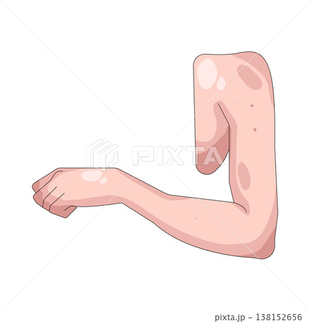Illustration of human elbow Illustration of human elbow 138152656