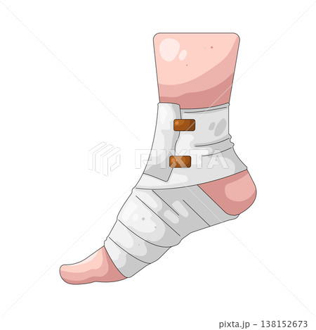 Illustration of broken leg Illustration of broken leg 138152673