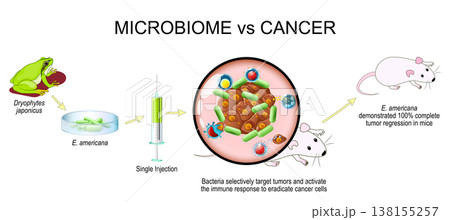 Microbiome and cancer. Cancer therapy. Experimental oncology. Microbiome and cancer. Cancer therapy. Experimental oncology. 138155257