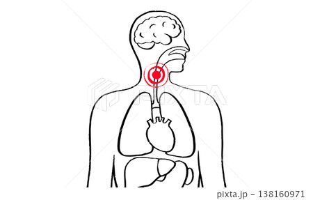 Throat inflammation pain 138160971