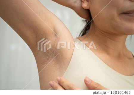 Asian woman have problem black armpit beauty skin care. Asian woman have problem black armpit beauty skin care. 138161463