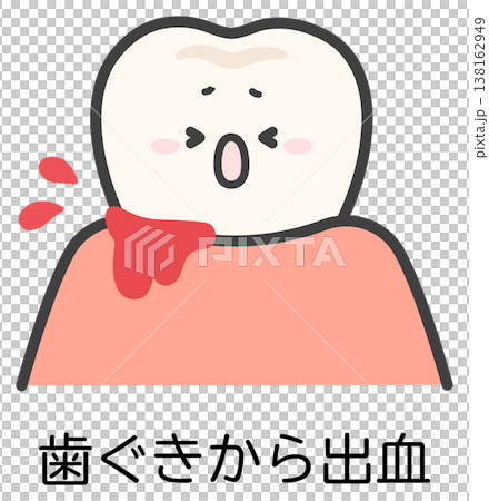 一張牙齦出血的牙齒示意圖。 138162949