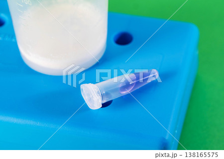 Sperm analysis of prostate fluid and ejaculate for infection and microscopy. Male infertility, presence of motile sperm, close-up 138165575
