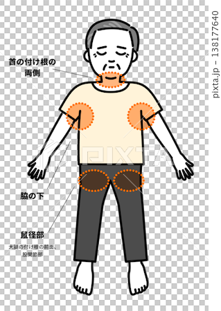 熱中症になった時に冷やす体の部位 138177640