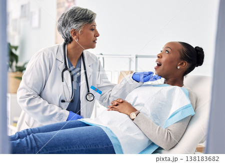 Dentist, patient and women at clinic, consultation and check mouth for dental health and medical treatment. Oral hygiene, healthcare and surgery, orthodontics and tooth decay with cleaning for cavity 138183682