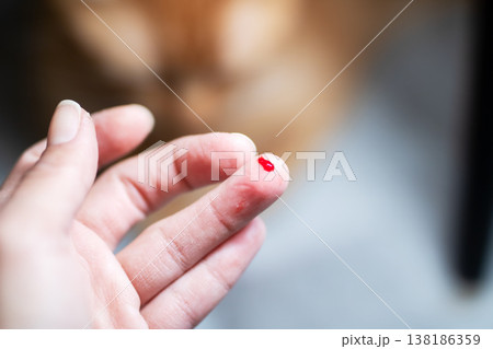 Intimate scene of self testing blood glucose with gentle sheen and blurry cat silhouette Intimate scene of self testing blood glucose with gentle sheen and blurry cat silhouette 138186359