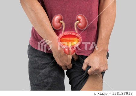 Man with Symptoms of Benign Prostatic Hyperplasia (BPH) or Enlarged Prostate Man with Symptoms of Benign Prostatic Hyperplasia (BPH) or Enlarged Prostate 138187918