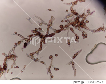 台所のシリコンに生えた黒かびの顕微鏡写真 138192524