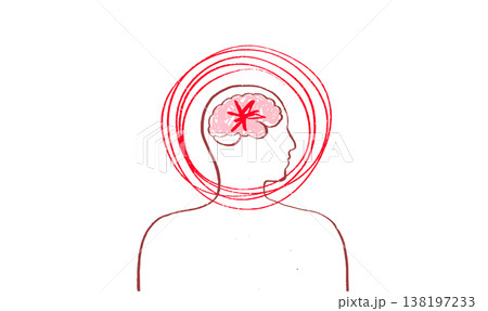 Brain disease concept 138197233