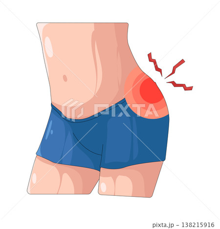 Illustration of Buttock pain Illustration of Buttock pain 138215916