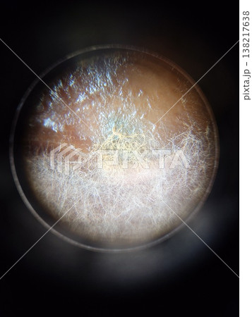 実体顕微鏡で見たカビの生育状態 138217638