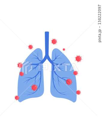 Human Lung With Virus Cells. Lung Infection Concept stock illustration Human Lung With Virus Cells. Lung Infection Concept stock illustration 138222097