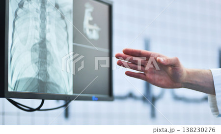 Hand of a doctor pointing at an x-ray and 3D medical model on a monitor Hand of a doctor pointing at an x-ray and 3D medical model on a monitor 138230276