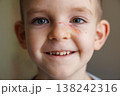 Close-up portrait of smiling young boy with a scratch on his face 138242316