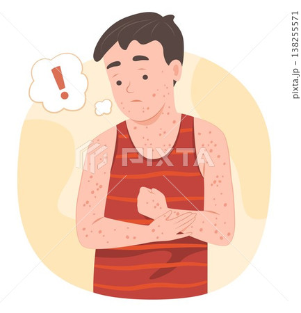 Young Kid Boy Worried with Chickenpox on Body for Dermatology Disease and Healthcare and Medical Concept Illustration Young Kid Boy Worried with Chickenpox on Body for Dermatology Disease and Healthcare and Medical Concept Illustration 138255571