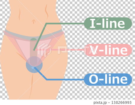 VIO脫毛示意圖 138266993