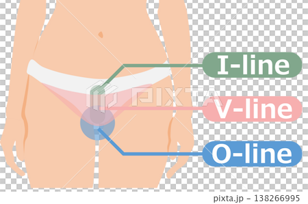 VIO脫毛示意圖 138266995