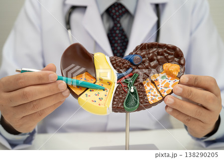 Liver with gallbladder, pancreas spleen and duodenum, Asian doctor holding human anatomy model for study diagnosis and treatment in hospital. 138290205