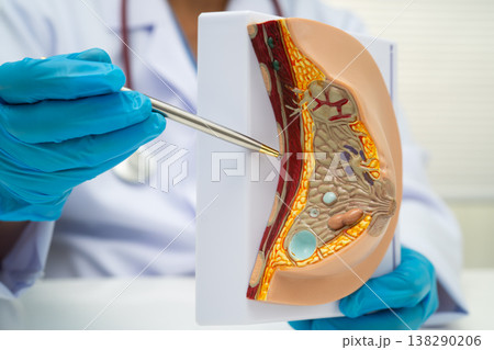 doctor holding female breast human anatomy model. 138290206