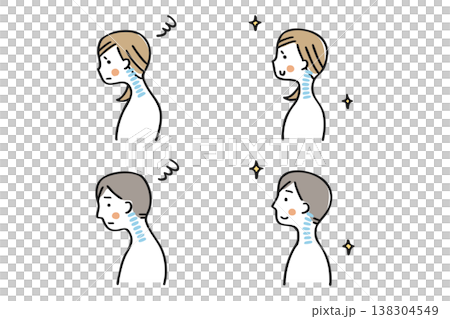 圖示對比直頸與正常姿勢（男性和女性組①） 138304549