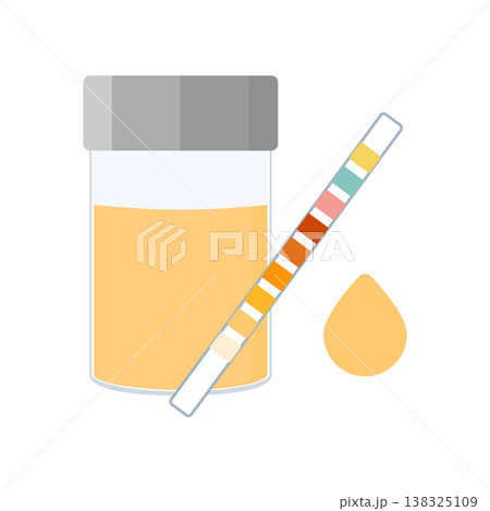Urine sample cup and urinalysis reagent strip for kidney exam, urinary tract infection and cystitis diagnostics.  138325109