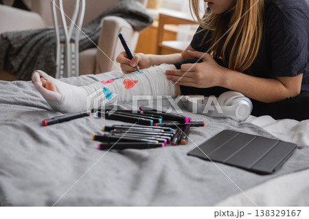 Young teenage girl with broken leg sitting on bed draws with felt tip pens on orthopedic cast. Bored girl with broken leg playing at home during rehabilitation. Accident injury fracture treatment Young teenage girl with broken leg sitting on bed draws with felt tip pens on orthopedic cast. Bored girl with broken leg playing at home during rehabilitation. Accident injury fracture treatment 138329167
