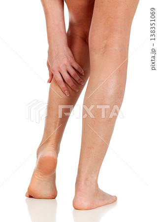 Female legs with vascular stars on the skin, isolated. Woman touches her shin with her hand Female legs with vascular stars on the skin, isolated. Woman touches her shin with her hand 138351069